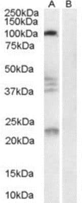 Western Blot: Nogo Receptor/NgR Antibody [NB100-1536]