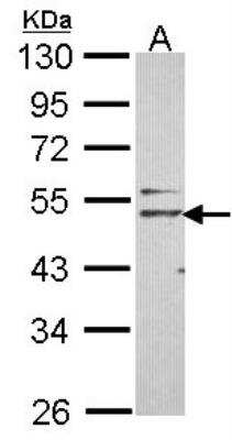 Western Blot: Nogo Receptor/NgR Antibody [NBP2-15043]