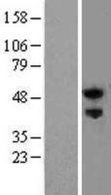 Western Blot: Nogo Receptor/NgR Overexpression Lysate [NBL1-15614]