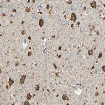 Immunohistochemistry-Paraffin: Nope/IGDCC4 Antibody [NBP1-92195]