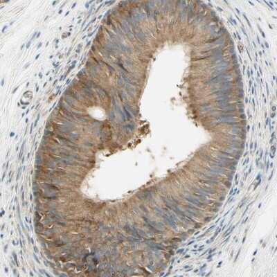 Immunohistochemistry-Paraffin: Nope/IGDCC4 Antibody [NBP1-92195]