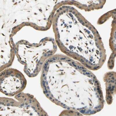 Immunohistochemistry-Paraffin: Nope/IGDCC4 Antibody [NBP1-92195]
