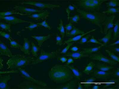 Immunocytochemistry/ Immunofluorescence: Nope/IGDCC4 Antibody (6A3) [H00057722-M05]