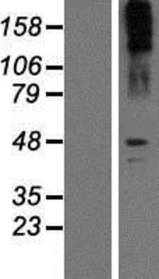 Western Blot: SLC6A2/NET/Noradrenaline transporter Overexpression Lysate [NBP2-10902]