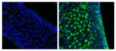 Fluorescence Imaging: Normal Rabbit Serum [NBP1-71681]