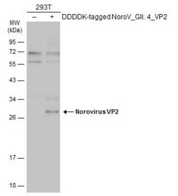 Western Blot: Norovirus VP2 Antibody [NBP3-13385]