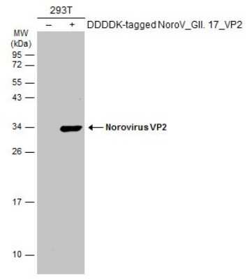 Western Blot: Norovirus VP2 Antibody [NBP3-13386]