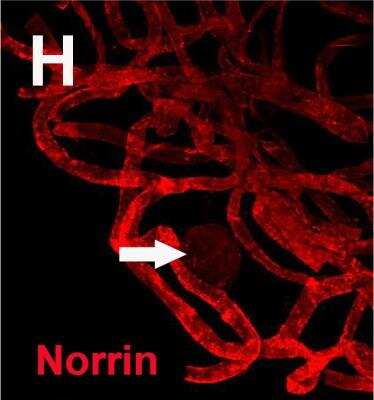 Immunocytochemistry/ Immunofluorescence: Norrin/NDP Antibody [NBP1-59305]