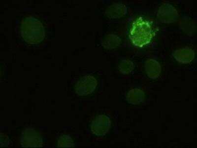 Immunocytochemistry/ Immunofluorescence: Notch-1 Antibody (OTI3E12) [NBP1-48289]