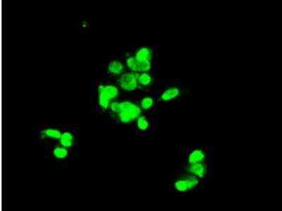 Immunocytochemistry/ Immunofluorescence: Notch-1 Antibody (OTI3E12) [NBP1-48289]