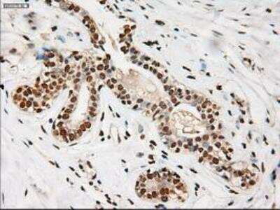 Immunohistochemistry-Paraffin: Notch-1 Antibody (OTI3E12) [NBP1-48289]