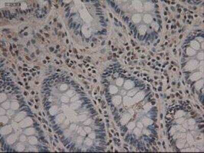 Immunohistochemistry-Paraffin: Notch-1 Antibody (OTI3E12) [NBP1-48289]