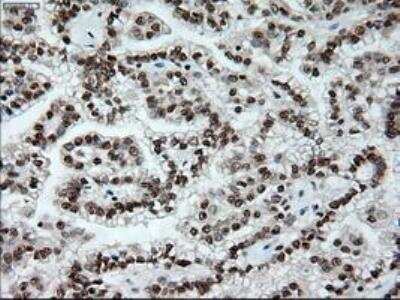 Immunohistochemistry-Paraffin: Notch-1 Antibody (OTI3E12) [NBP1-48289]