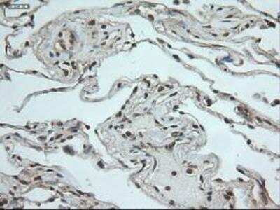 Immunohistochemistry-Paraffin: Notch-1 Antibody (OTI3E12) [NBP1-48289]