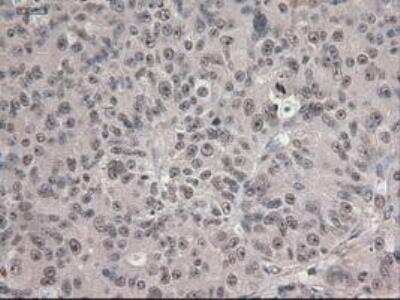 Immunohistochemistry-Paraffin: Notch-1 Antibody (OTI3E12) [NBP1-48289]