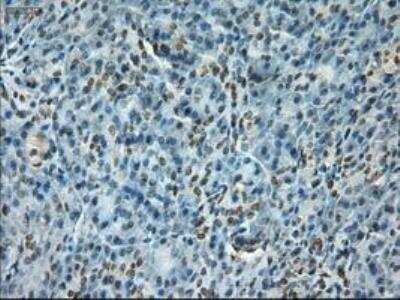 Immunohistochemistry-Paraffin: Notch-1 Antibody (OTI3E12) [NBP1-48289]