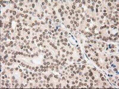 Immunohistochemistry-Paraffin: Notch-1 Antibody (OTI3E12) [NBP1-48289]