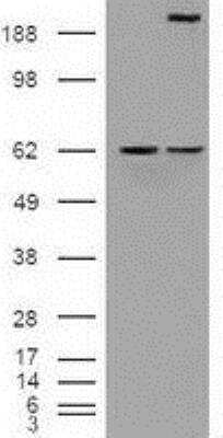 Western Blot: Notch-1 Antibody (OTI3E12) [NBP1-48289]