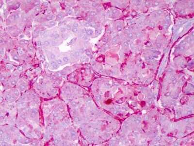 Immunohistochemistry: Notch-1 Antibody - (Cleaved N terminal) [NB300-251]