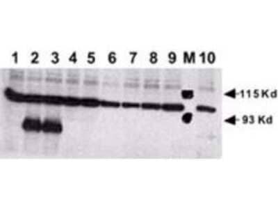 Western Blot: Notch-1 Antibody(Cleaved N terminal) [NB300-251]