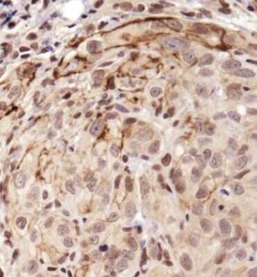 Immunohistochemistry: Notch-1 Antibody - BSA Free [NBP1-78292]