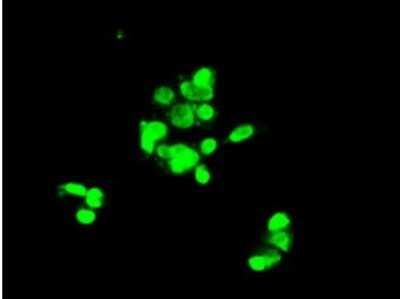 Immunocytochemistry/ Immunofluorescence: Notch-1 Antibody (OTI3E12) - Azide and BSA Free [NBP2-73042]