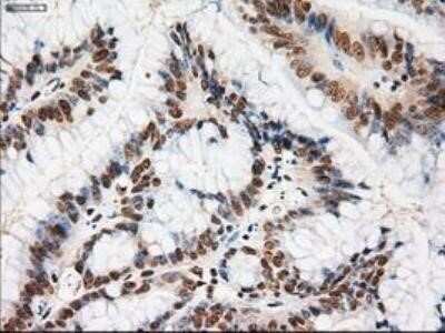 Immunohistochemistry: Notch-1 Antibody (OTI3E12) - Azide and BSA Free [NBP2-73042]