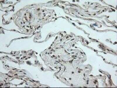 Immunohistochemistry: Notch-1 Antibody (OTI3E12) - Azide and BSA Free [NBP2-73042]