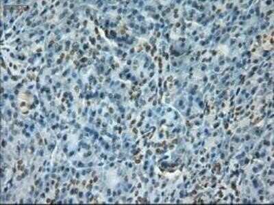 Immunohistochemistry: Notch-1 Antibody (OTI3E12) - Azide and BSA Free [NBP2-73042]