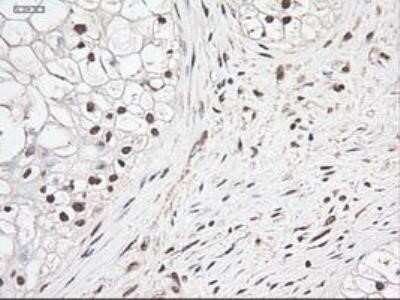 Immunohistochemistry: Notch-1 Antibody (OTI3E12) - Azide and BSA Free [NBP2-73042]