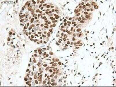 Immunohistochemistry: Notch-1 Antibody (OTI3E12) - Azide and BSA Free [NBP2-73042]
