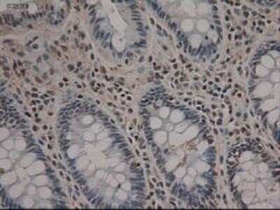 Immunohistochemistry: Notch-1 Antibody (OTI3E12) - Azide and BSA Free [NBP2-73042]