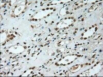 Immunohistochemistry: Notch-1 Antibody (OTI3E12) - Azide and BSA Free [NBP2-73042]