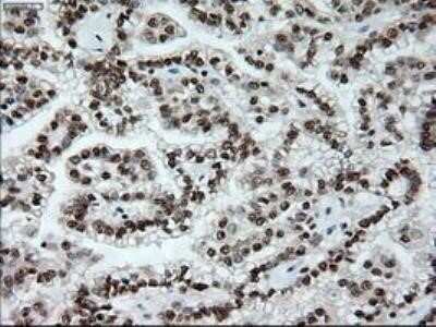 Immunohistochemistry: Notch-1 Antibody (OTI3E12) - Azide and BSA Free [NBP2-73042]