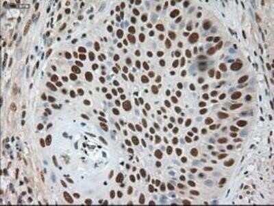 Immunohistochemistry: Notch-1 Antibody (OTI3E12) - Azide and BSA Free [NBP2-73042]