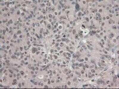 Immunohistochemistry: Notch-1 Antibody (OTI3E12) - Azide and BSA Free [NBP2-73042]
