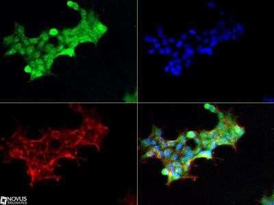 Immunocytochemistry/ Immunofluorescence: Notch-1 Antibody (mN1A) - Azide and BSA Free [NBP2-80884]