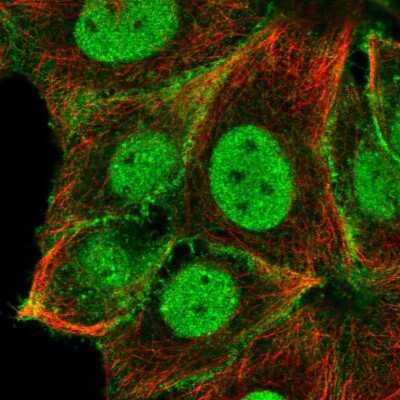 Immunocytochemistry/ Immunofluorescence: Notch-2 Antibody [NBP2-48913]