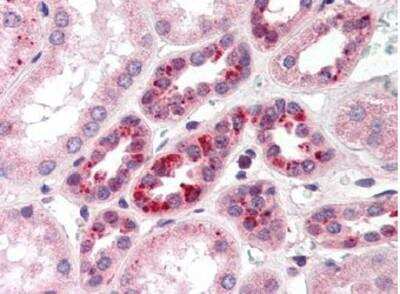 Immunohistochemistry-Paraffin: Notch-2 Antibody [NB600-879]