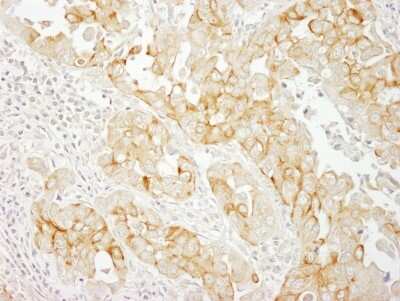 Immunohistochemistry-Paraffin: Notch-2 Antibody [NBP1-19125]
