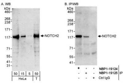 Western Blot: Notch-2 Antibody [NBP1-19125]