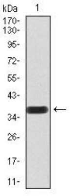 Western Blot: Notch-3 Antibody (2E4D11)BSA Free [NBP2-52521]