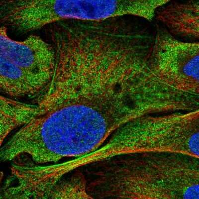 Immunocytochemistry/ Immunofluorescence: Notch-3 Antibody [NBP2-48812]