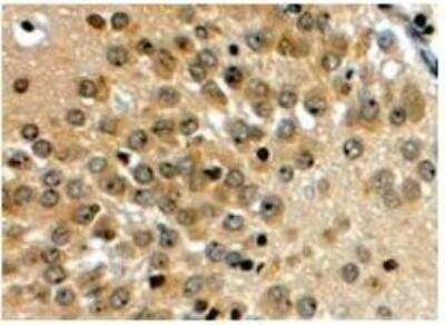 Immunohistochemistry-Paraffin: Notch-3 Antibody [NB100-2414]