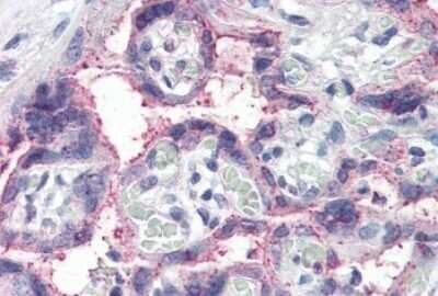 Immunohistochemistry-Paraffin: Notch-3 Antibody [NB100-2414]