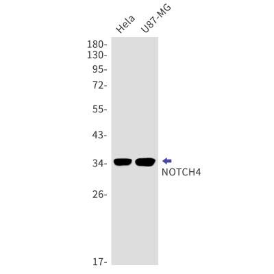 Western Blot: Notch-4 Antibody (S08-8H5) [NBP3-19822]