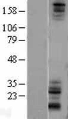 Western Blot: Notch-1 Overexpression Lysate [NBL1-13725]