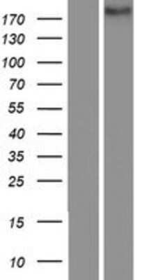 Western Blot: Notch-4 Overexpression Lysate [NBP2-04274]