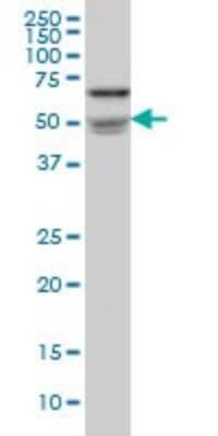 Western Blot: Nova1 Antibody (3F3) [H00004857-M07]