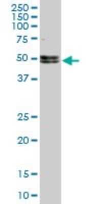 Western Blot: Nova1 Antibody (5D9) [H00004857-M10]